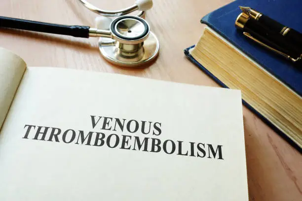 Photo of Book with title Venous thromboembolism VTE.