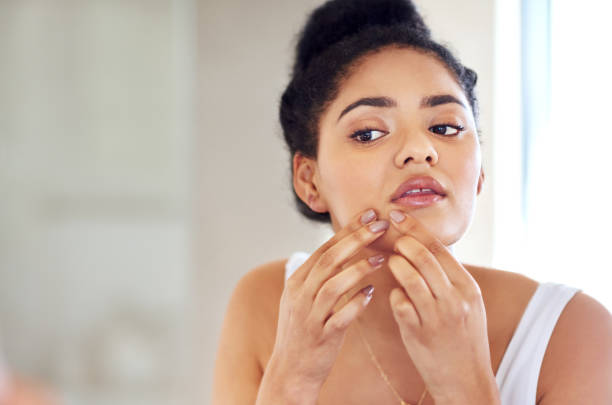 There must be an easier way to get rid of this... Shot of a young woman squeezing a pimple on her face in the bathroom pimple stock pictures, royalty-free photos & images