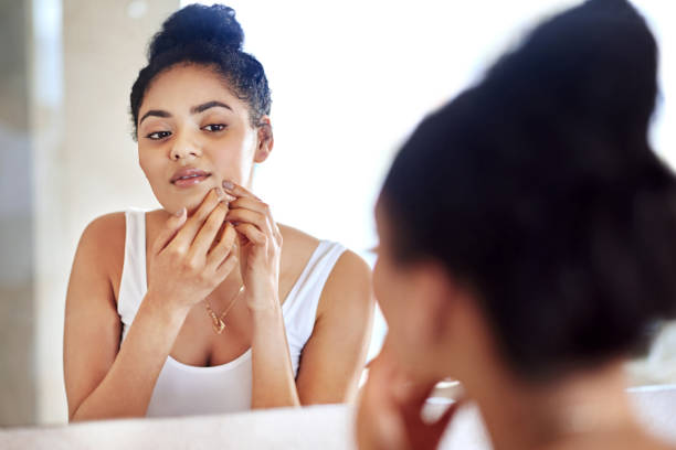 istock Just when I thought my face was clearing up... 887303078