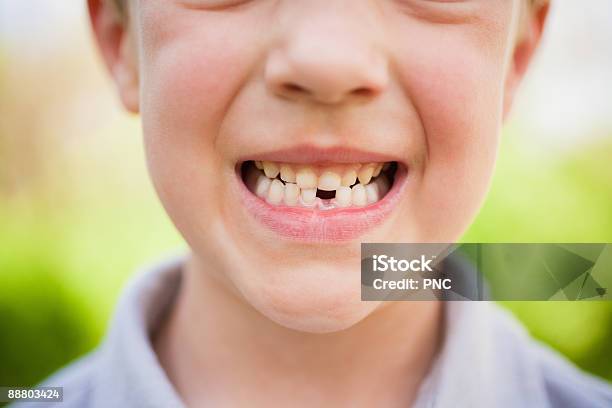 Smiling Kid With Mising Tooth ภาพสต็อก - ดาวน์โหลดรูปภาพตอนนี้ - ยิงฟัน - บูดบึ้ง, เด็ก - อายุ, กลางวัน