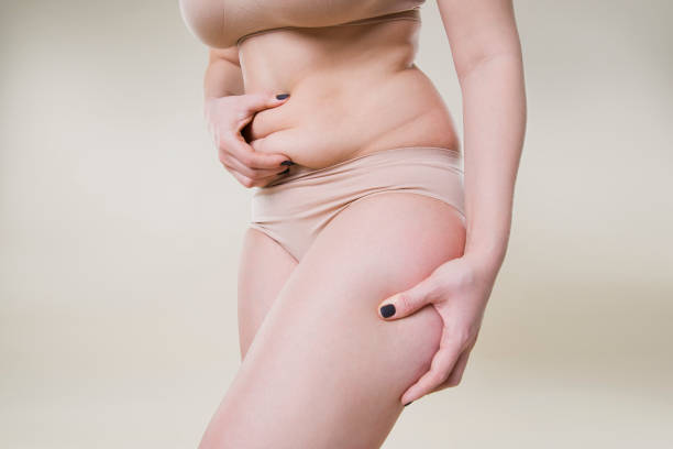 woman holding fold of skin, cellulite on female body - overweight women body abdomen imagens e fotografias de stock