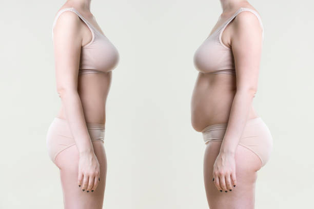 frauen vor und nach der gewichtsabnahme - overweight women body abdomen stock-fotos und bilder