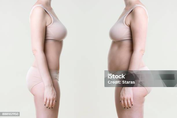 Womans Body Before And After Weight Loss Stock Photo - Download Image Now - Dieting, Before and After, The Human Body