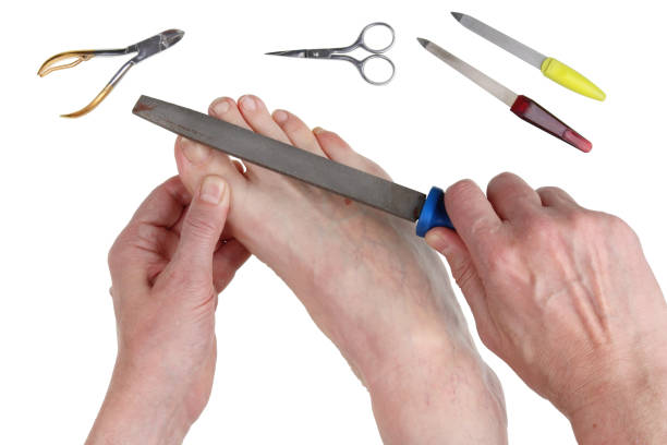 istock Real problems with leg nails in older men can be solved with a coarse steel file. 888109984