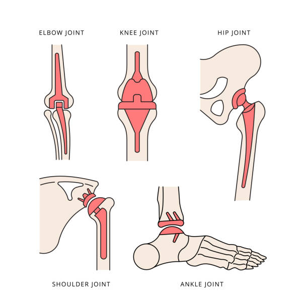이식 공동 해골 - hip femur ilium pelvis stock illustrations