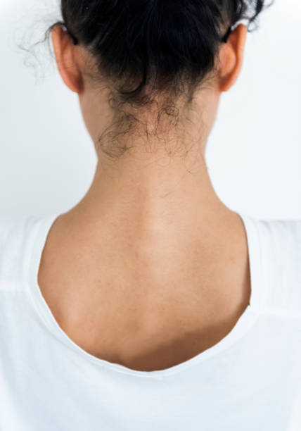 istock Woman showing her back 888675722