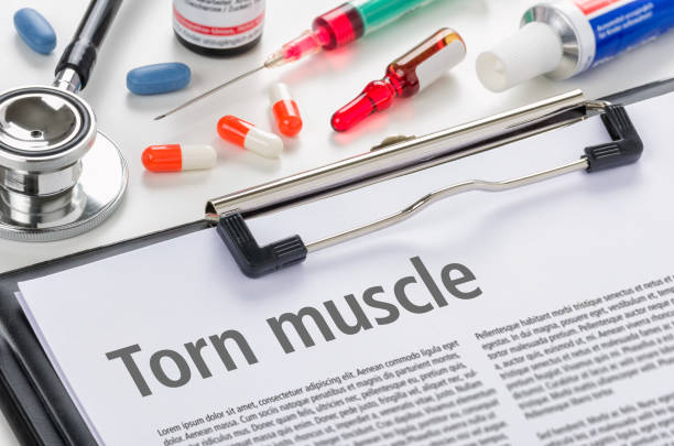 istock The diagnosis Torn muscle written on a clipboard 888759282