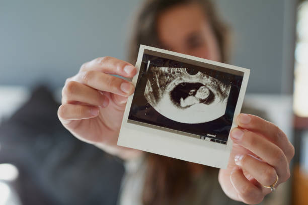 Look at my little peanut Shot of a woman holding a sonogram of her unborn baby showing photos stock pictures, royalty-free photos & images