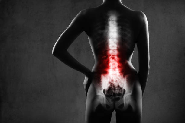 menschliche wirbelsäule im röntgenbild auf grauem hintergrund. - pelvic bone stock-fotos und bilder