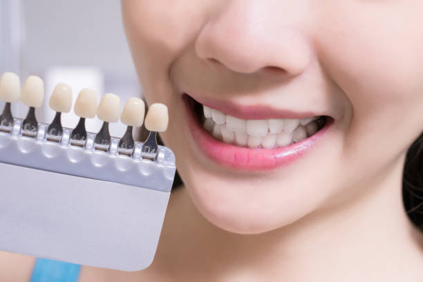 istock woman with tooth color palette 891337850