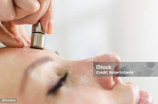 ダイヤモンド マイクロダーマブレーション皮膚顔療法美容スパ - マイクロピーリングのストックフォトや画像を多数ご用意 - マイクロピーリング, ヘルスケアと医療, 医薬品