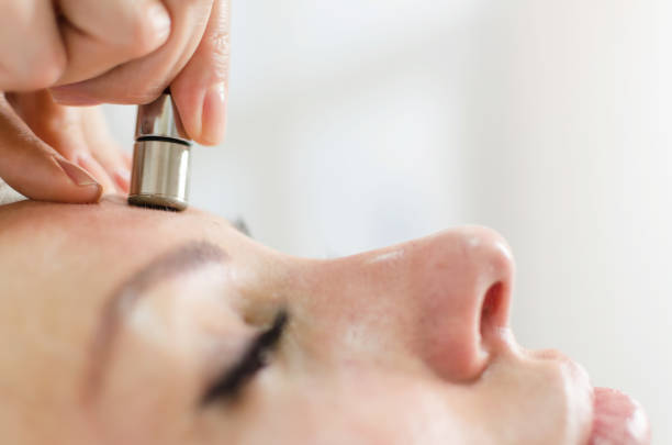 Diamond microdermabrasion skin face therapy in beauty spa Hardware cosmetology. Closeup portrait of female face with closed eyes getting microdermabrasion procedure in a beauty parlour. Procedure of Microdermabrasion microdermabrasion stock pictures, royalty-free photos & images