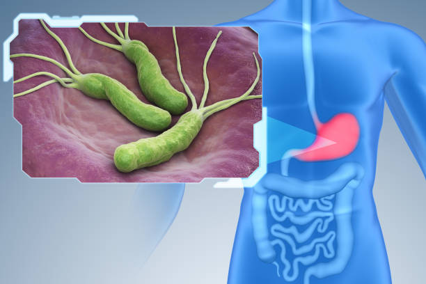 Helicobacter Pylori bacteria Helicobacter Pylori is a Gram-negative, microaerophilic bacterium found in the stomach. 3D illustration high scale magnification stock pictures, royalty-free photos & images