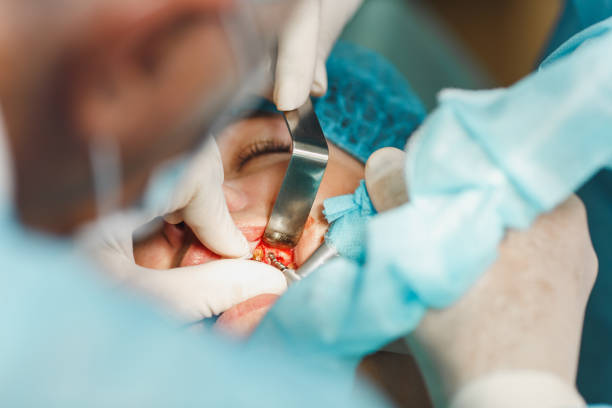 男性プロの歯科医師の外科医が操作を実行するプロセスをクローズ アップ現代のツール装備クリニック光オフィスで女性患者のインプラント歯をインストールします。血と顔に痛み。 - dental light dental equipment hospital professional occupation ストックフォトと画像