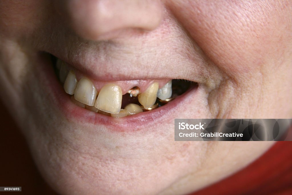 Chiama il dentista presto - Foto stock royalty-free di Adulto