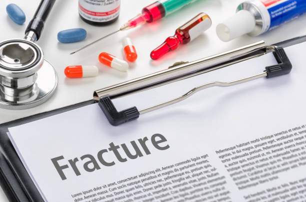 istock The diagnosis Fracture written on a clipboard 893470076