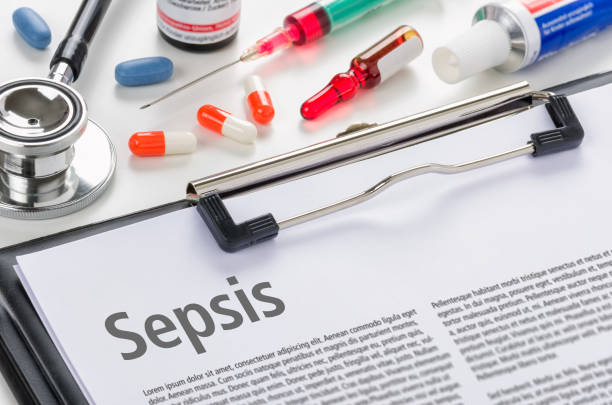 The diagnosis Sepsis written on a clipboard stock photo