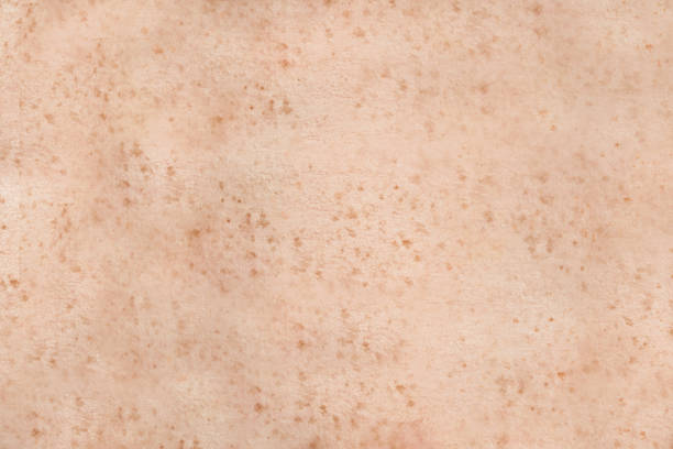Freckled human skin stock photo