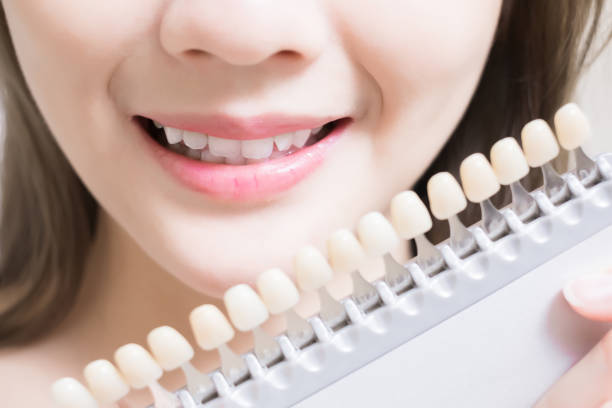 istock woman with tooth color palette 894183950