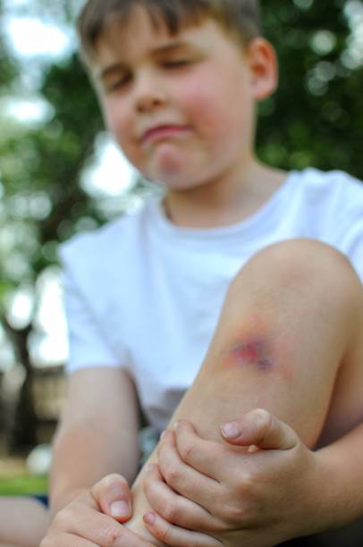 istock Childhood injuries 894799674