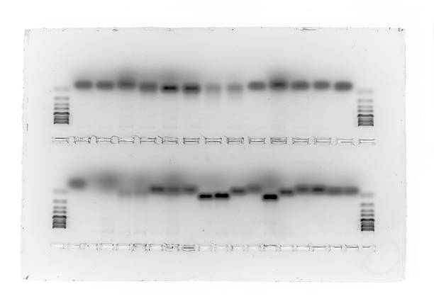 gel biologique - agarose photos et images de collection