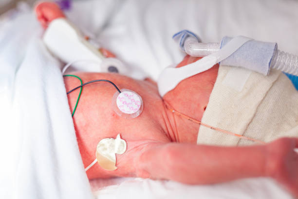 Head and chest of a premature Baby in the Neonatal Intensive Care Unit stock photo