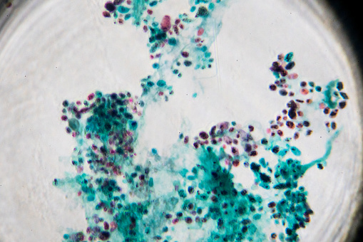 Yeasts sprout in microscopy