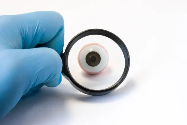 Diagnosis and detection of eye diseases pathologies associated with disruption of normal vision and anatomic abnormalities of optic organ concept photo. Diagnosis with magnifying glass directed at eye