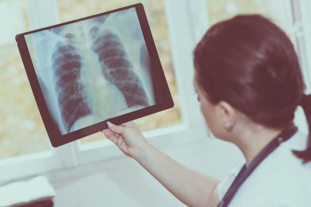 istock Doctor examining x-ray report 895671900