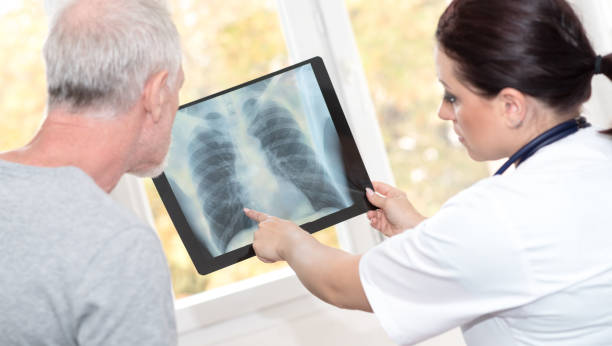 istock Doctor showing x-ray report to patient 895674766