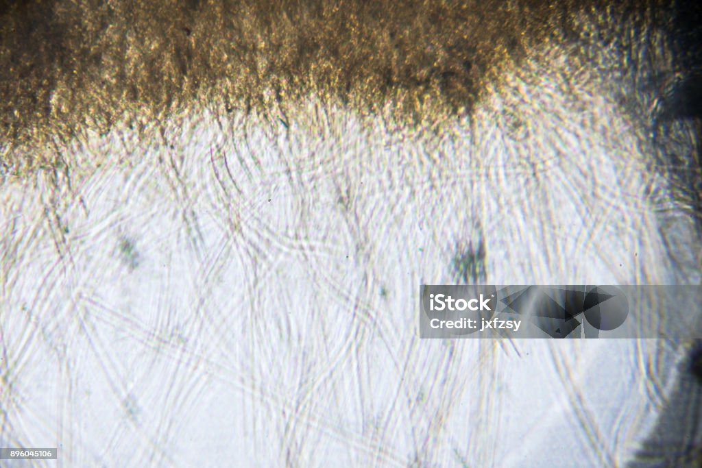 aspergillus under microscopy Fungal Mold Stock Photo