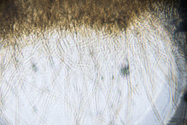 aspergillus under microscopy aspergillus under microscopy conidiophore photos stock pictures, royalty-free photos & images