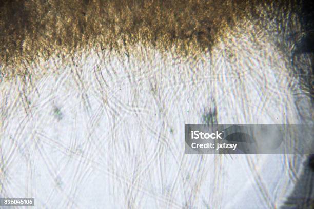 Aspergillus Under Microscopy Stock Photo - Download Image Now - Fungal Mold, Hypha, Microscope