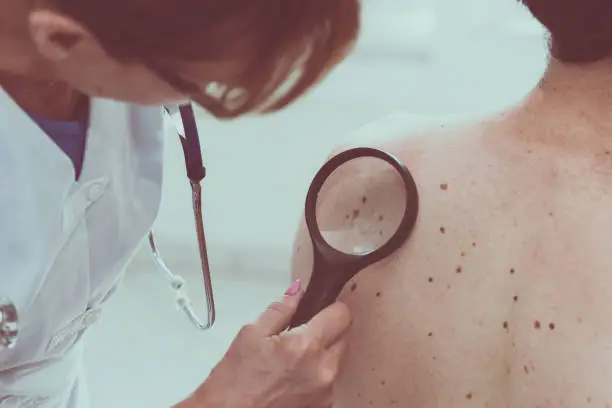 Dermatologist examining the skin on the back of a patient