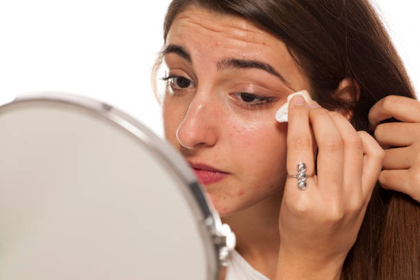 istock young woman cleans her face gets cotton pad 896094004