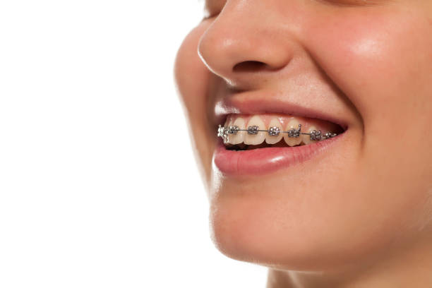 istock a smiling young woman with a dental prosthesis 896094040