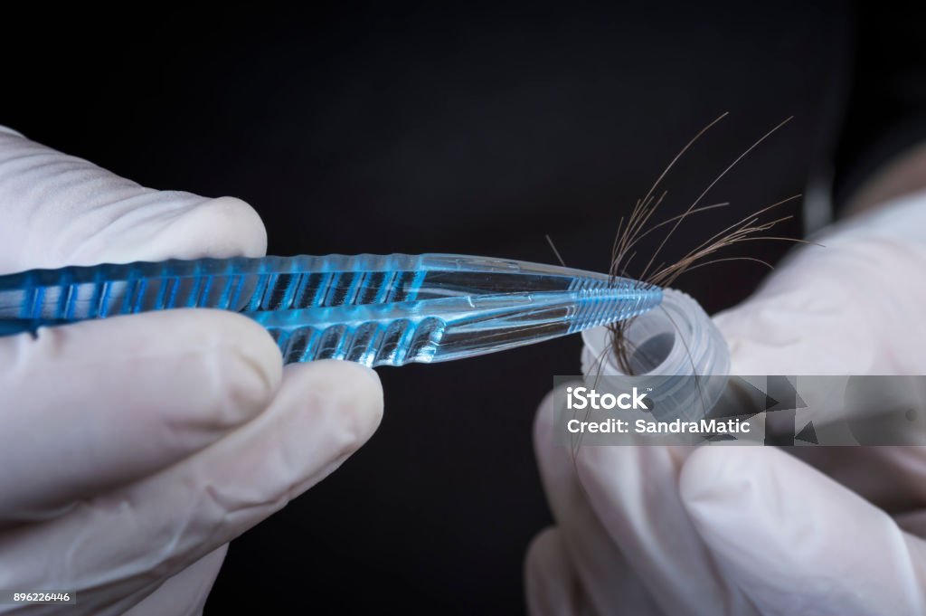 Ciencia forense - Foto de stock de Pelo libre de derechos