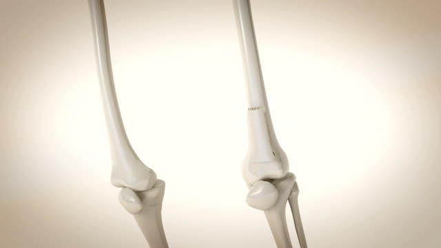 3,107 Osteoporosis Stock Videos and Royalty-Free Footage - iStock |  Osteoporosis bone, Bone density, Bone