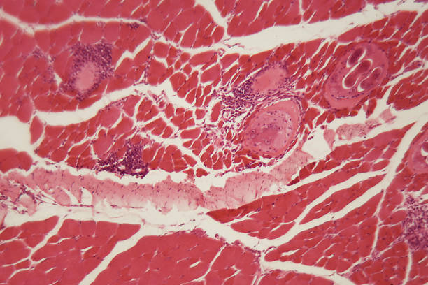 istock Trichinella spiralis larvae in muscle tissue under the microscope 896435500