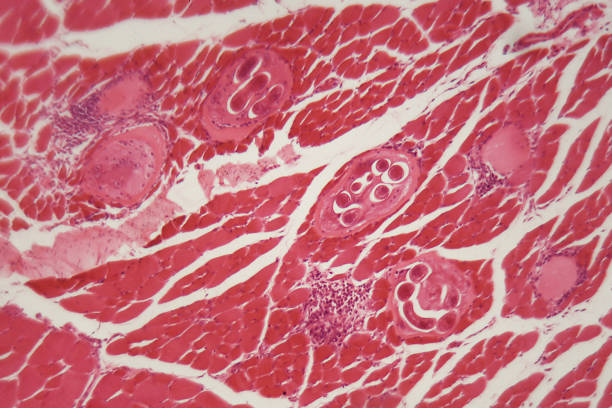 istock Trichinella spiralis larvae in muscle tissue under the microscope 896435776