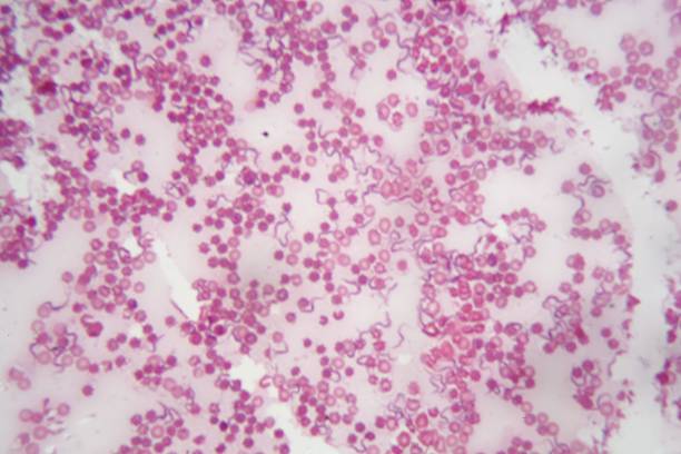 foto de microscópio de sangue humano com trypanosoma brucei - doença de chagas - fotografias e filmes do acervo