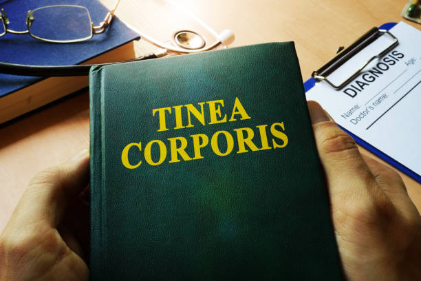 istock Hands holding book Tinea corporis. 896962870
