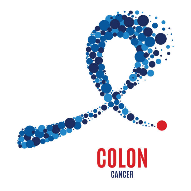 Colon cancer awareness ribbon. Colon cancer awareness poster. Blue ribbon made of dots on white background. Medical concept. Vector illustration. colon cancer screening stock illustrations