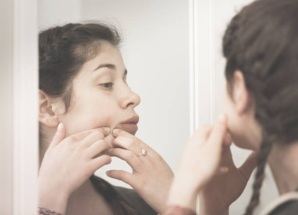 istock Girl cleaning pores 897509308