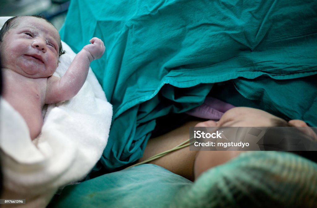 Newborn child seconds and minutes after birth. Caesarean Section Stock Photo