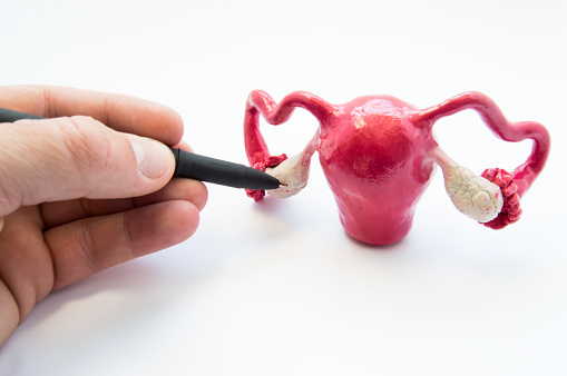 Doctor o maestro puntos de bolígrafo en ovarios en modelo anatómico de los órganos sexuales femeninos internos. Órgano de los ovarios donde se producen huevos, hormonas masculinas y femeninas, así como diversas enfermedades photo