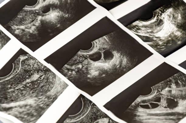 Photo shots of Medical ultrasound, diagnostic sonography or ultrasonography of foliculometry in the protocol of the ivf program Photo shots of Medical ultrasound, diagnostic sonography or ultrasonography of foliculometry in the protocol of the ivf program in the process of hormonal stimulation Ovulation stock pictures, royalty-free photos & images