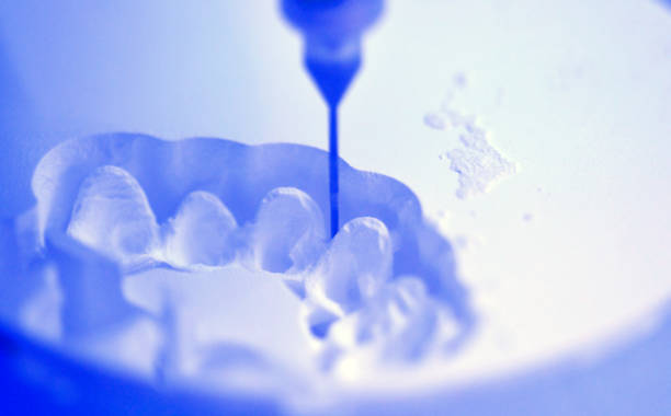 máquina de fresado dental tallando hacia fuera la forma de los dientes humanos - dental drill fotografías e imágenes de stock