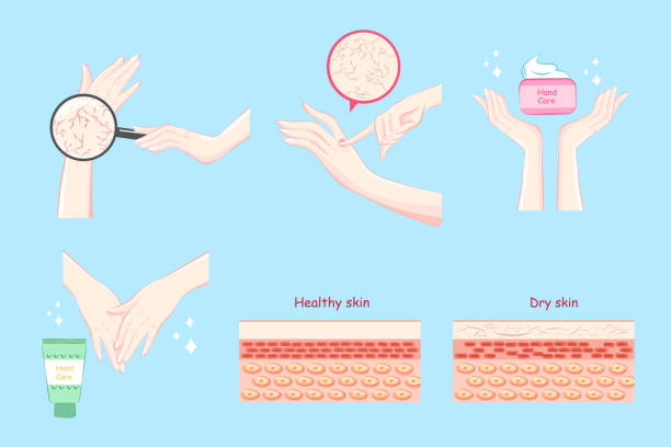 hand with skin care hand with skin care on the blue background dry skin stock illustrations