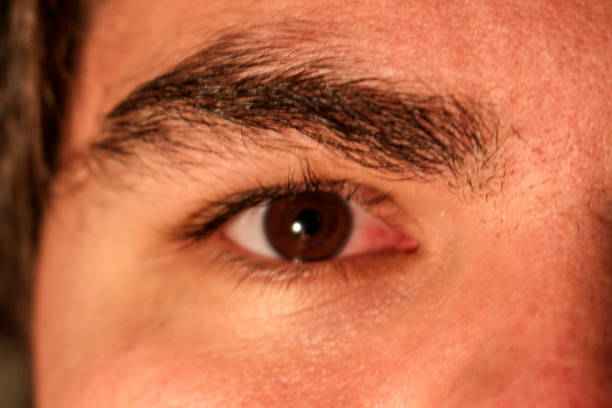 istock Male brown eye with redness in it 898242034